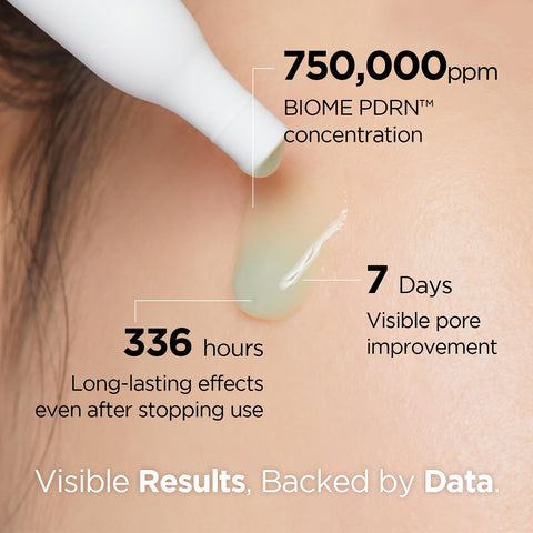 PoreXsome Triple Power Pore Care