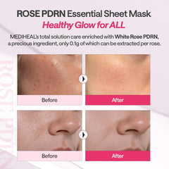 Rose PDRN Essential Mask Healthy Glow 10 Sheets