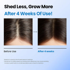 Scalpy Hair Serum 20ml