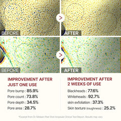 Peel Shot Exfoliating White Rice Ampoule 80ml