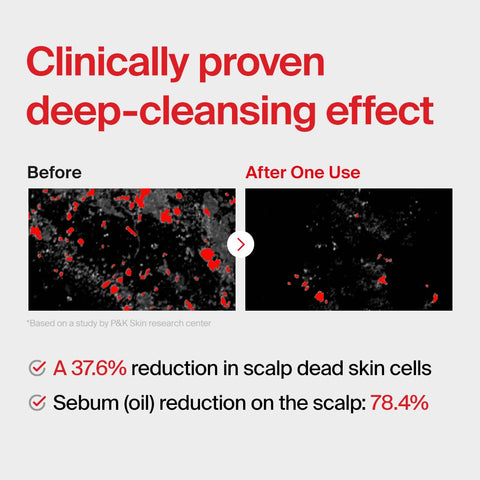 Folligen Original Shampoo 500ml