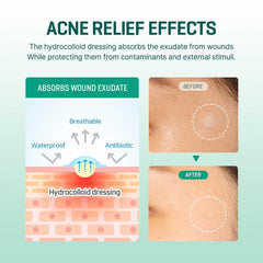 Parche Miracle Clear Spot de 30 días (18 pegatinas)