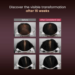 RGIII Premium Hair Care Set