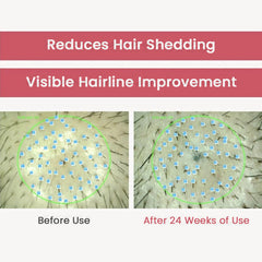 RGIII Hair Loss Clinic Shampoo 3 Set