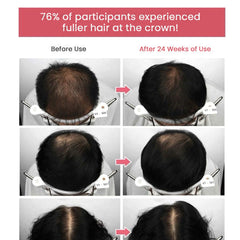 RGIII Hair Loss Clinic Shampoo 3 Set