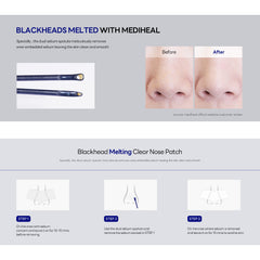 Blackhead Melting Clear Nose Patch 4 Pack